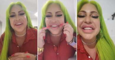 La Diosa estrena sonrisa en Miami: "Me parezco a Shakira"