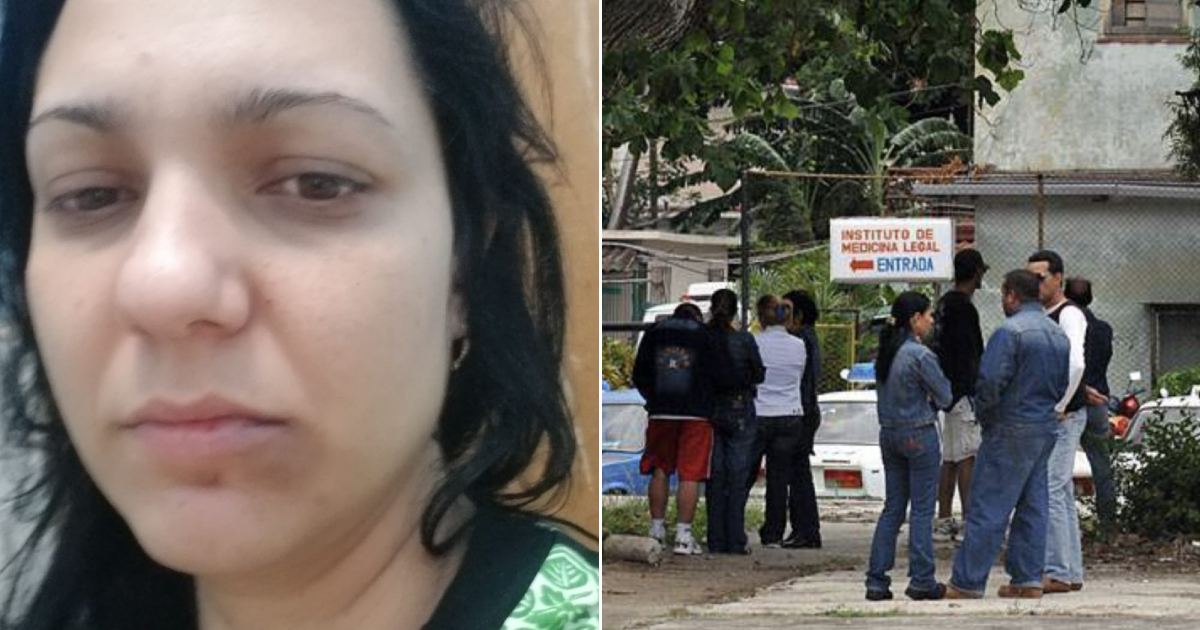 Cubana golpeada por padre de sus hijos denuncia dilación del caso en Medicina  Legal